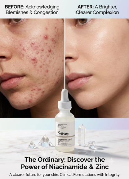The Ordinary Niacinamide 10% + Zinc 1% – 30ml